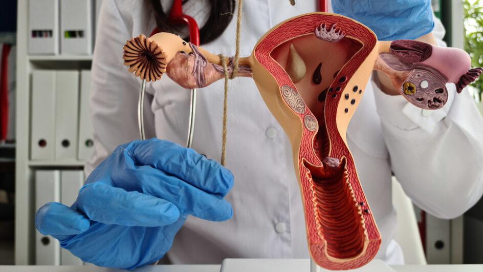 SAIBA COMO FAZER UMA LAQUEADURA PELO SUS E QUAIS OS PRÉ-REQUISITOS EXIGIDOS POR LEI
