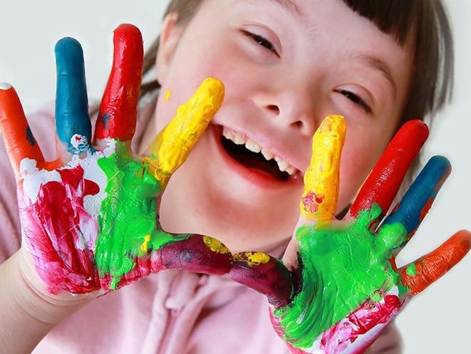 21 DE MARÇO: DIA MUNDIAL DA SÍNDROME DE DOWN